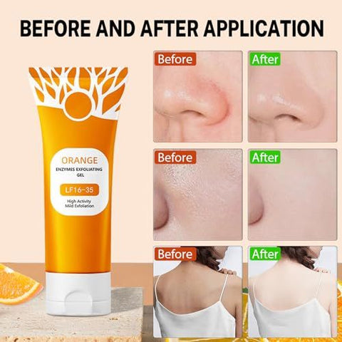 Orange Brightening Exfoliating Gel - remove dead skin cells, unclog pores