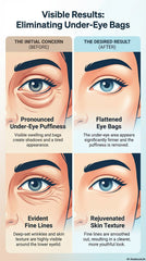 👁️ DR. MELAXIN EYEPHALT CREAM