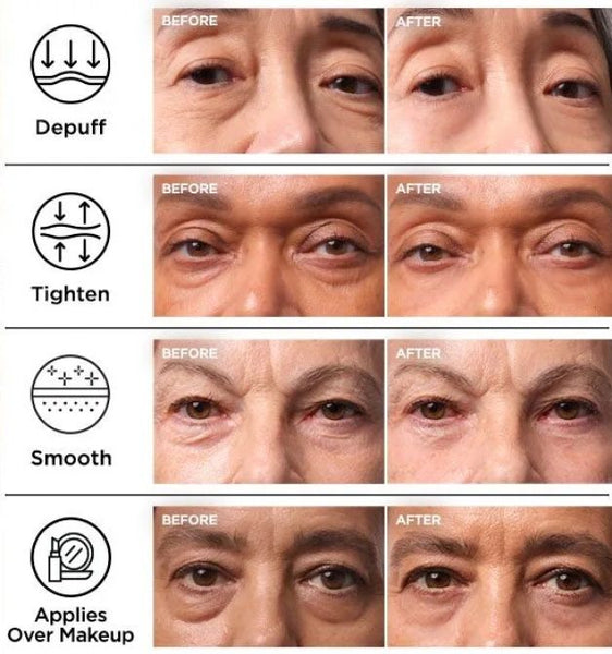 👁️ DR. MELAXIN EYEPHALT CREAM